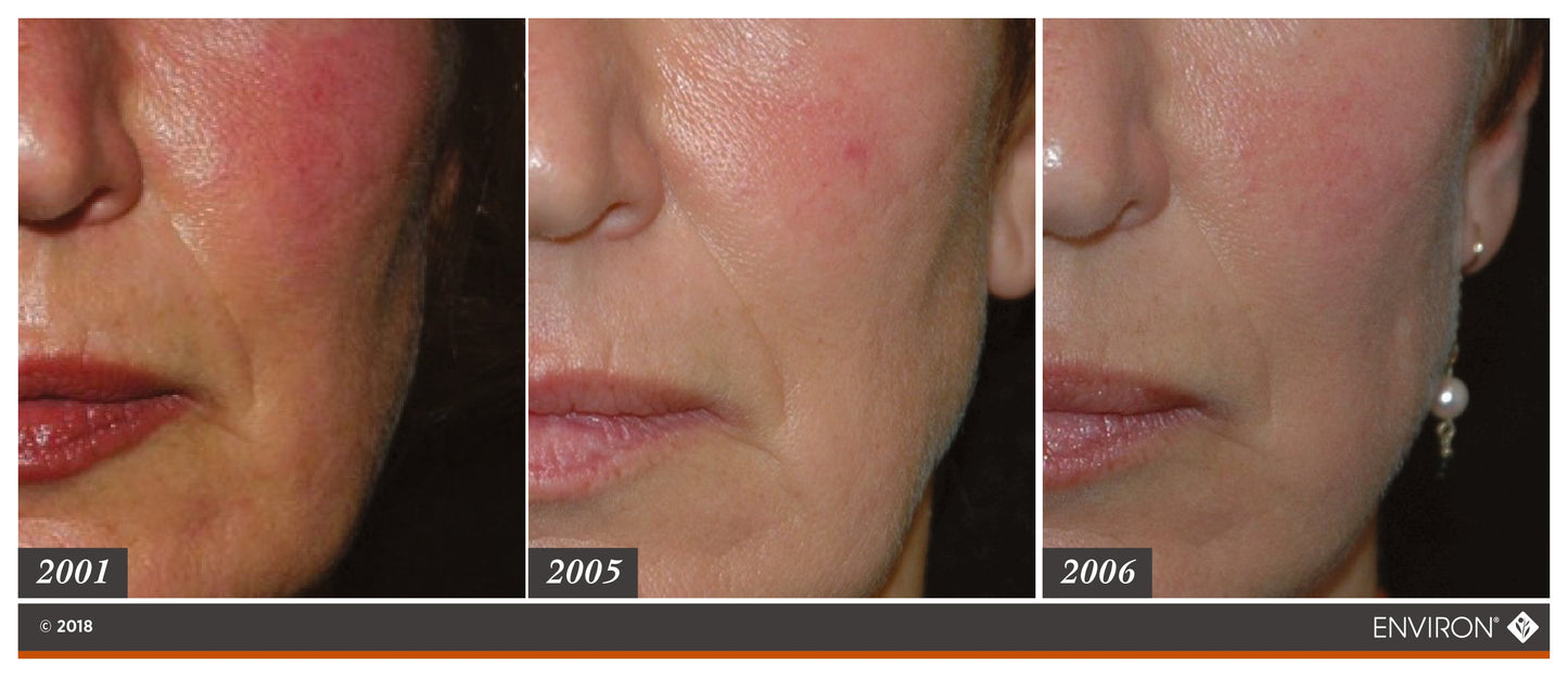 Environ Skin EssentiA Beginners Kit